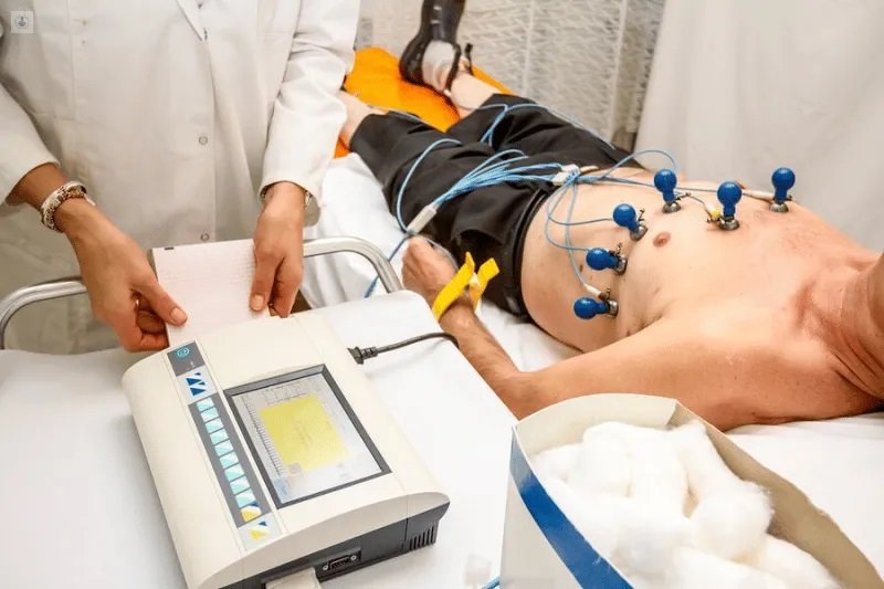  ¿Qué es un electrocardiograma y cuándo deberías realizarte uno?